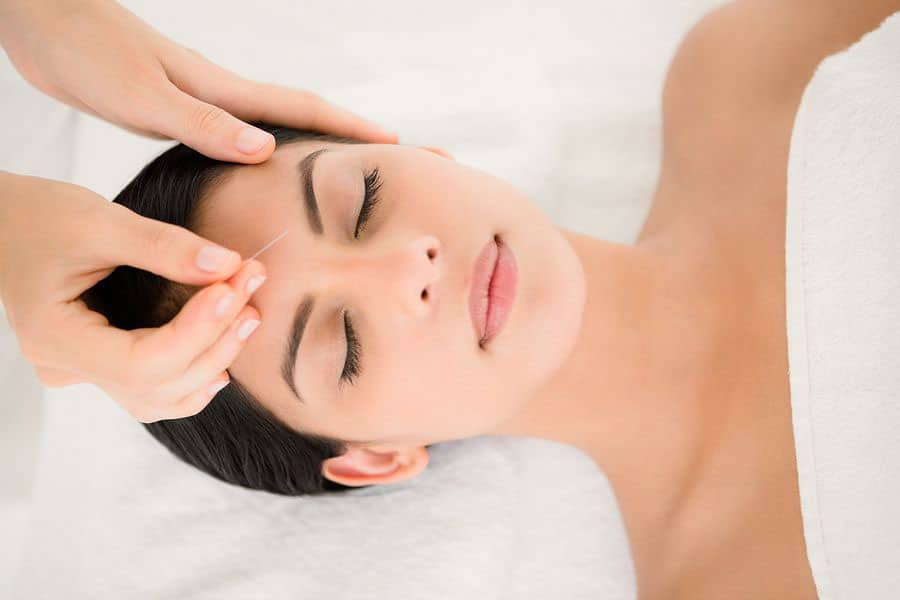 Acupuncture Acupuncture Services
