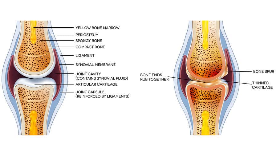 Platelet Rich Plasma Platelet Rich Plasma