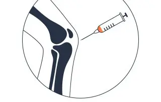 Platelet-rich Plasma Knee Treatment Linear Medical Poster